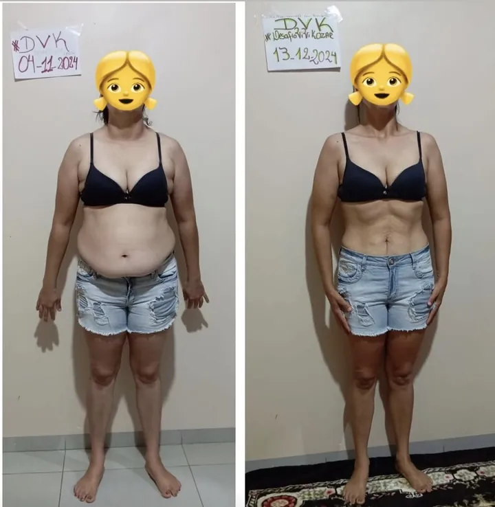 Comparativo frontal antes e depois de uma participante do DVK